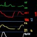 Medical monitor